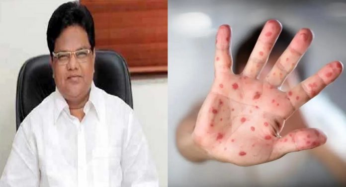 health minister Dr Tanaji Sawant to take an immediate meeting after measles deaths in Mumbai